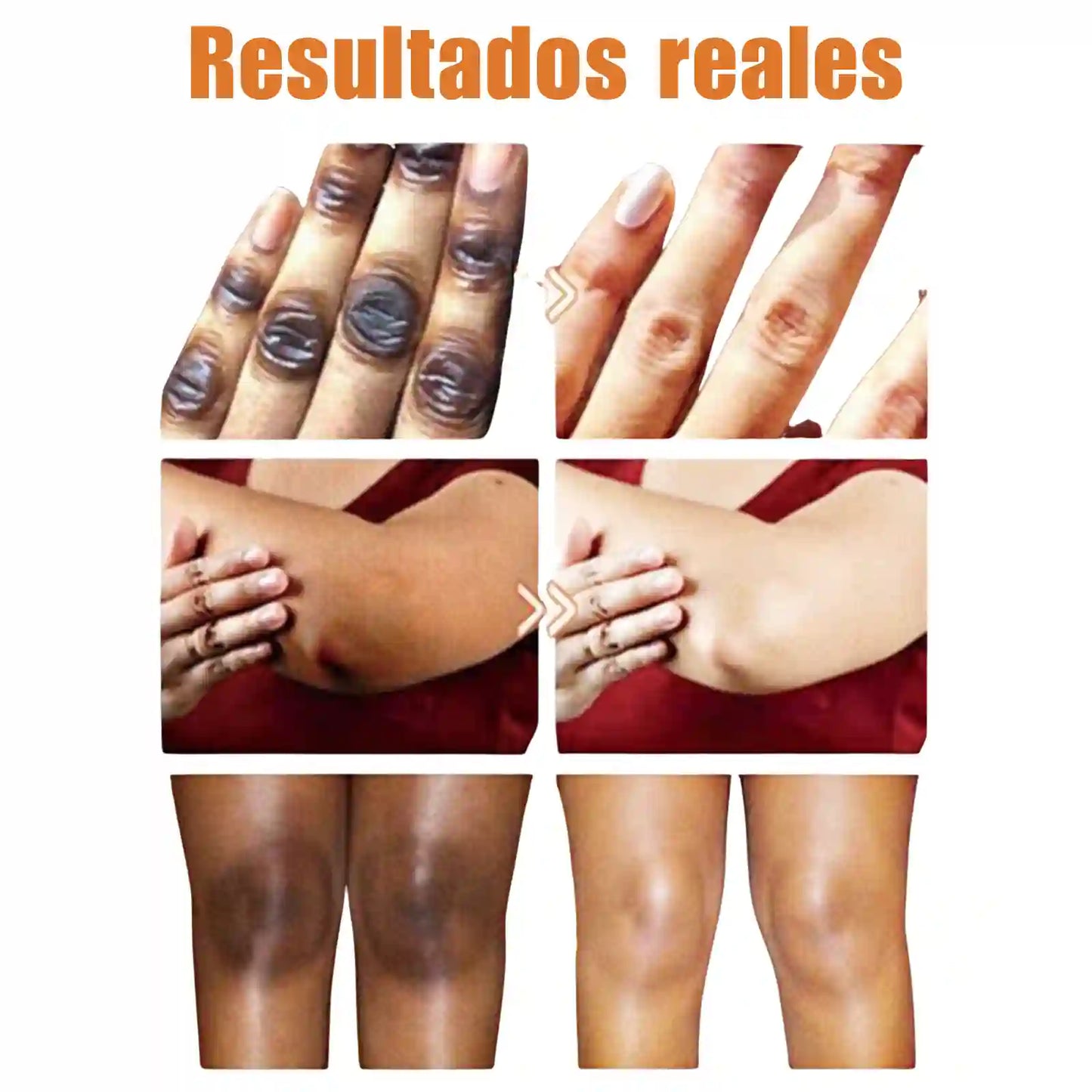 Serum aclarador de nudillos, codos y rodillas/