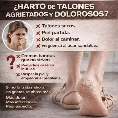¿Talones agrietados que duelen y dan pena mostrar? Bálsamo Heel Balm