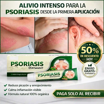 Psoriasis Solución Natural Para Calmar y Aliviar Tu Piel