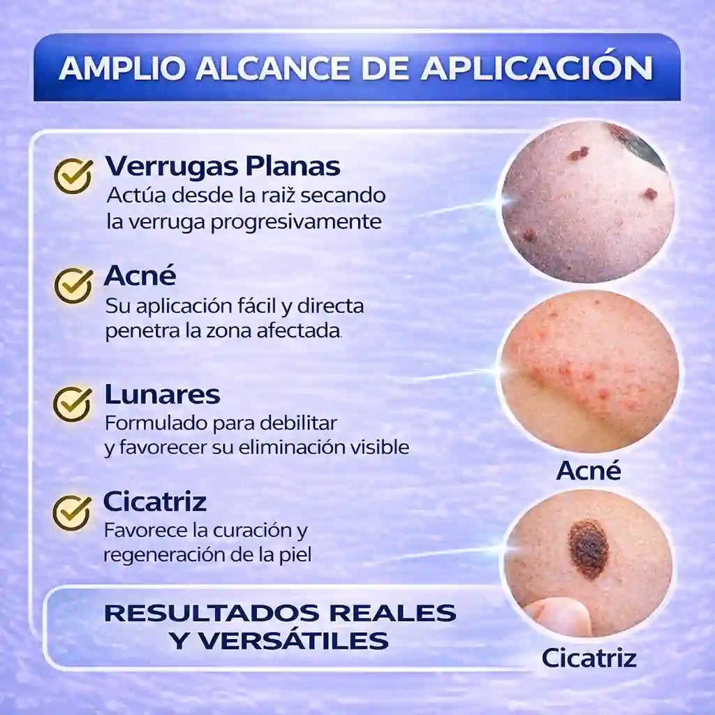 Wart Remover Elimina Tus Verrugas YA