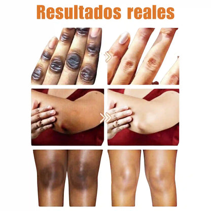 Serum aclarador de nudillos, codos y rodillas/