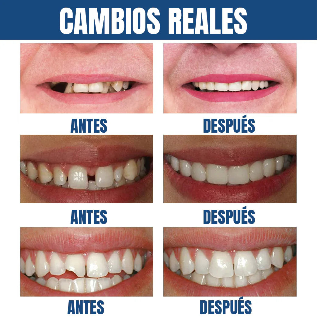 Sonrisa perfecta al instante-Envío Gratis
