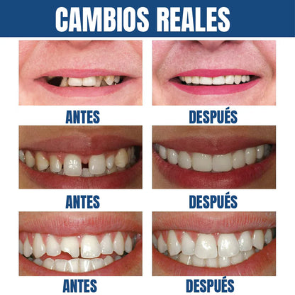 Sonrisa perfecta al instante-Envío Gratis