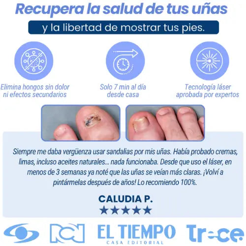 Láser Antihongos elimínalos para siempre y desde casa
