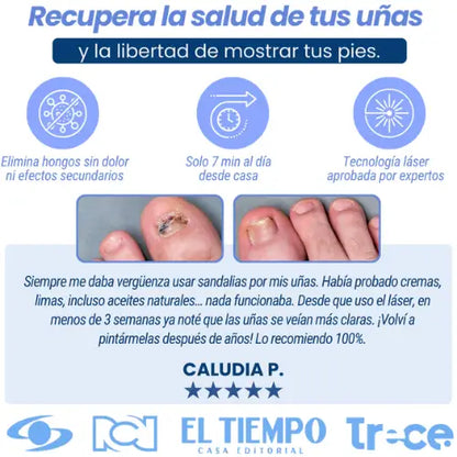 Láser Antihongos elimínalos para siempre y desde casa