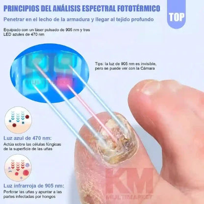 Láser Antihongos elimínalos para siempre y desde casa