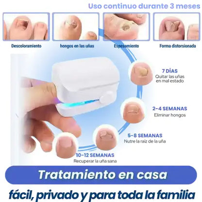 Láser Antihongos elimínalos para siempre y desde casa