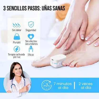 Láser Antihongos elimínalos para siempre y desde casa